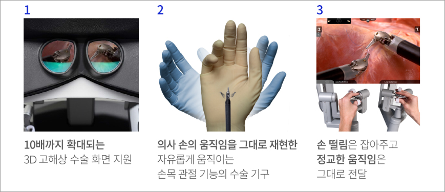 로봇수술의 장점