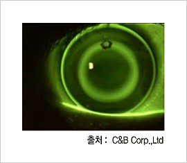 렌즈착용모습