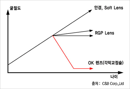 Contex OK Lens의 장점